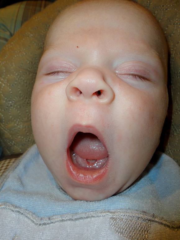 THAT's how you yawn! (170.95 KB)